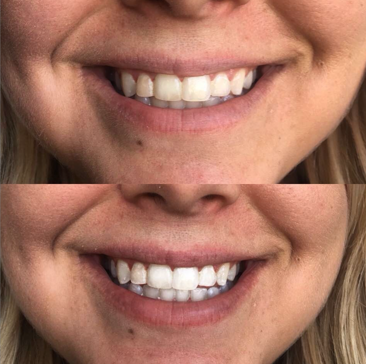 beaut. |cozy smile kit